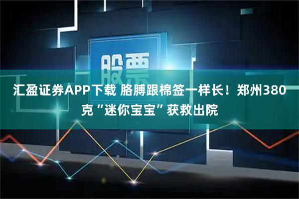 汇盈证券APP下载 胳膊跟棉签一样长！郑州380克“迷你宝宝”获救出院